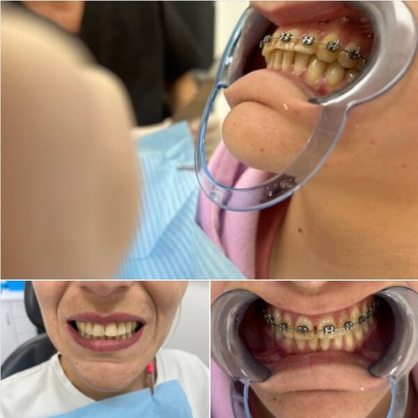 Ortodoncia clinica dental Nuovadente 1 600x600