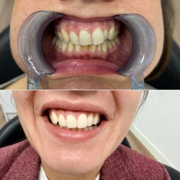 Ortodoncia clinica dental Nuovadente 2 600x600