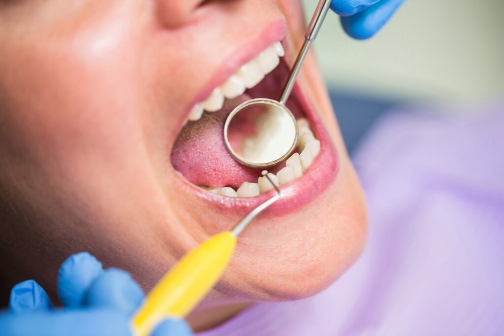 Periodoncia nuovadente