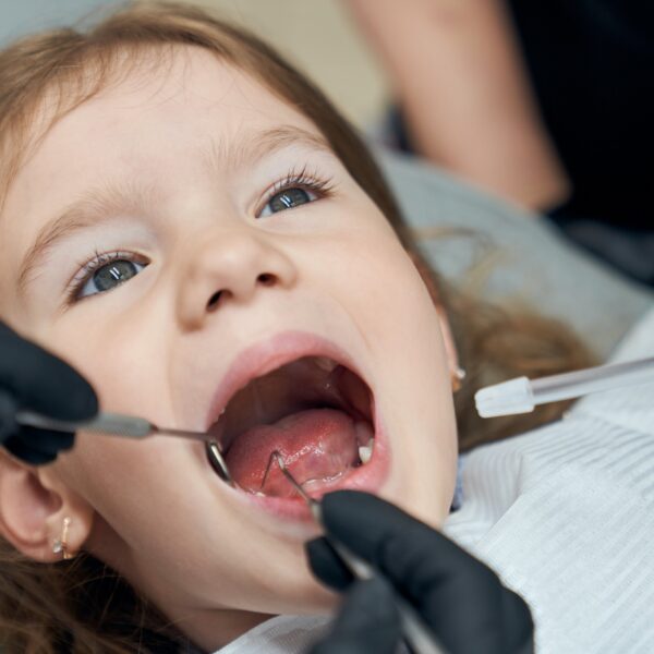 Plan de Asistencia Dental Infantil de Extremadura (PADIEX) NUOVADENTE