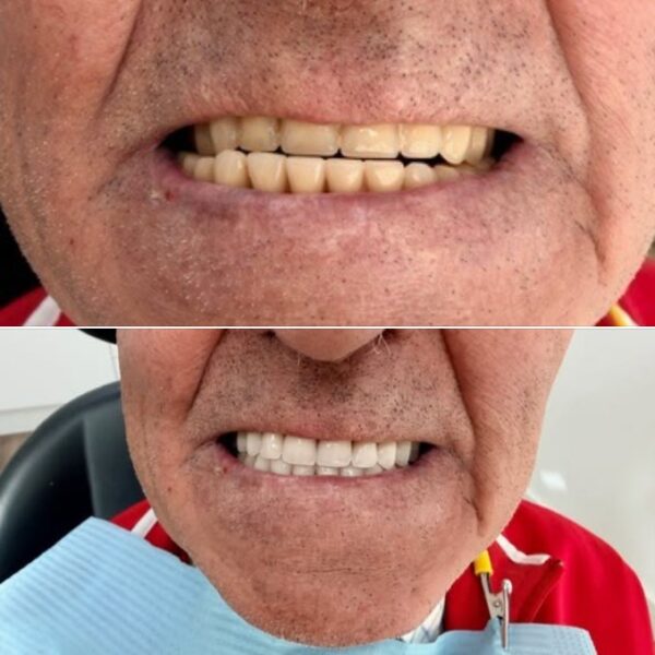 Protesis clinica dental Nuovadente 2 600x600