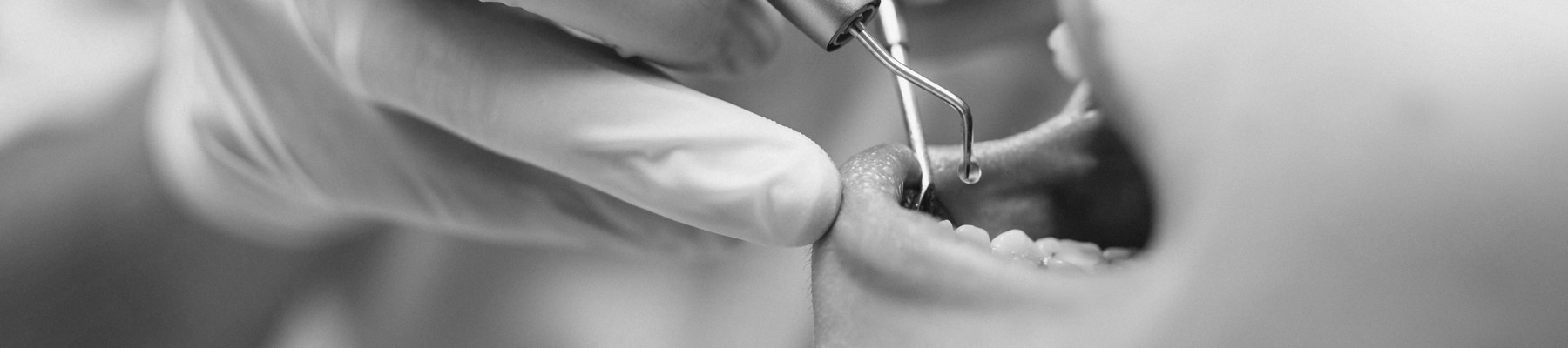 Nuovadente inicio dentis