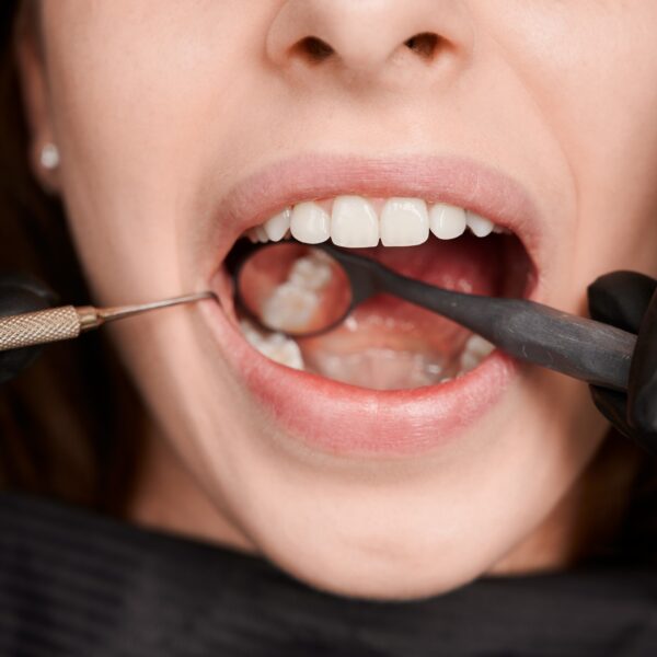 Periodoncia Nuovadente