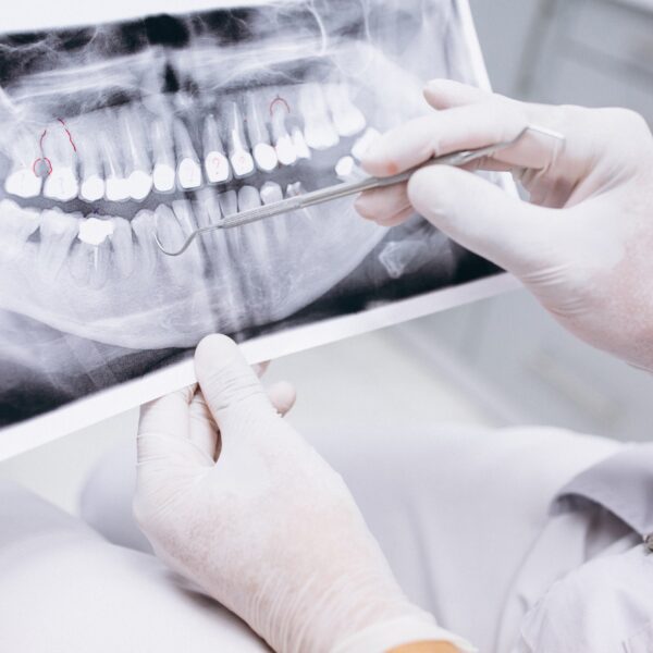 Periodoncia Nuovadente
